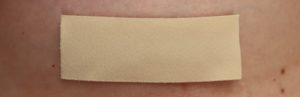 silicone sheet for covering scar